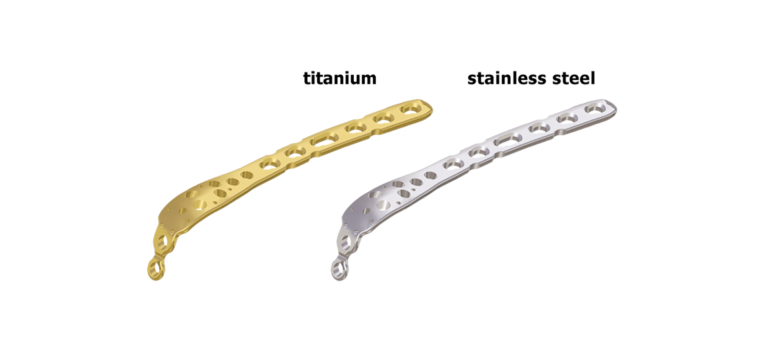 LCP-Olecranon-Plate-1