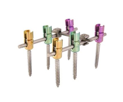 Lumbar-Thoracic-Sacral-Posterior-Fixation-System